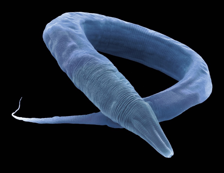 C. Elegans türü bir yuvarlak solucanın taramalı elekton mikroskobu görüntüsü