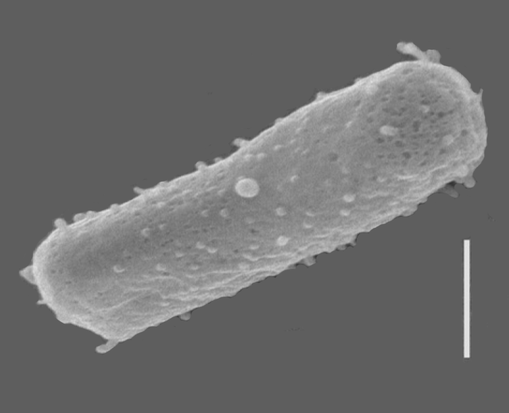 Aşırı tuzlu ortamlarda bile yaşayabilen Halobacterium salinarum