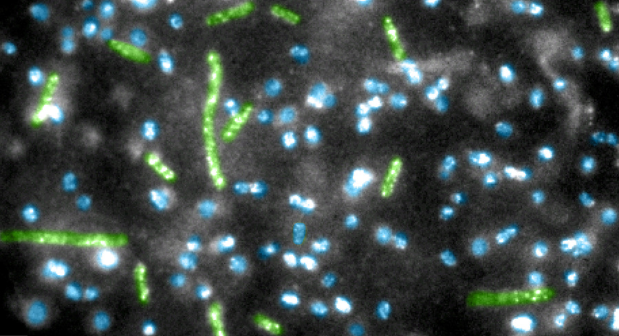 bakterilere bağlanan kuantum noktalar