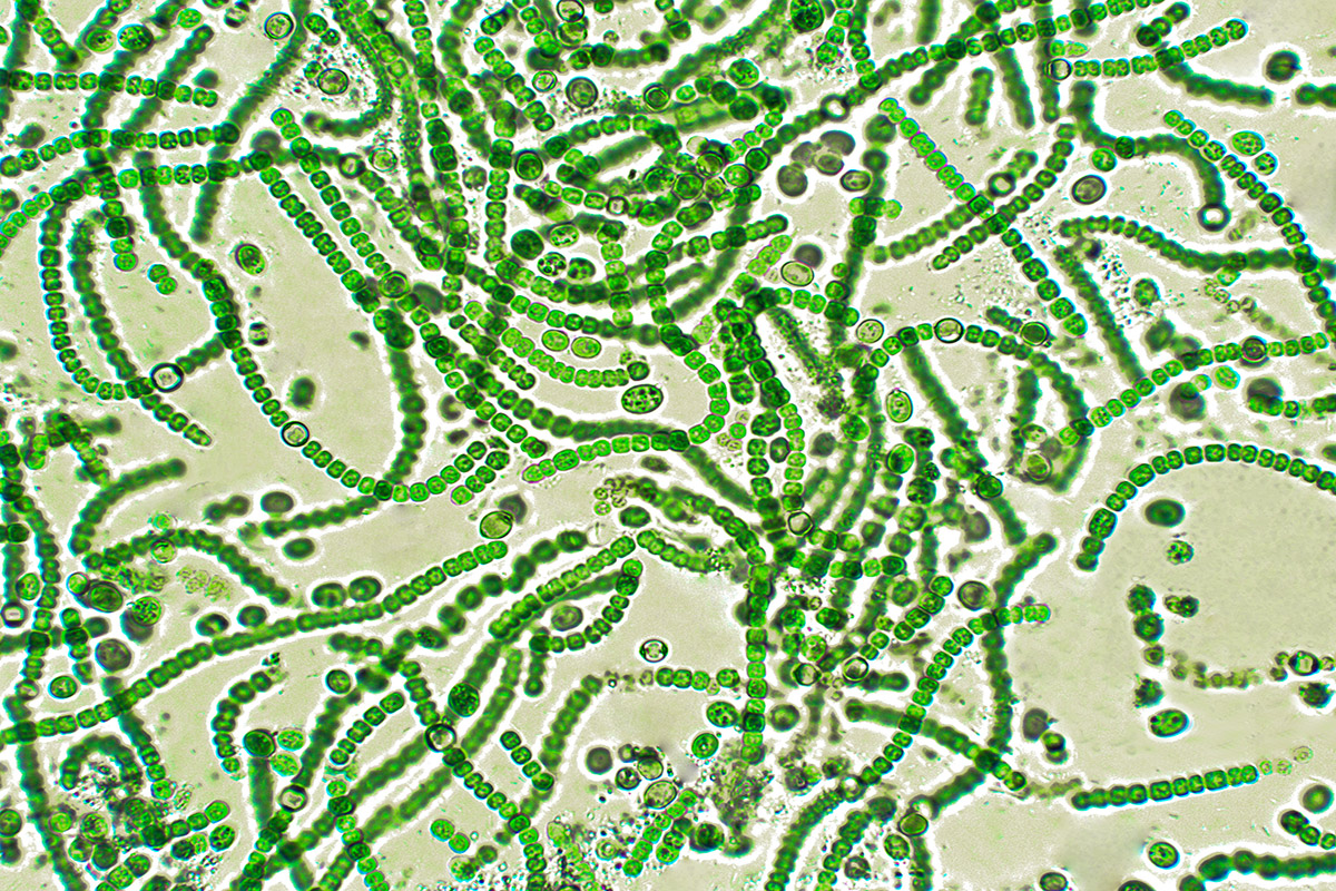Mavi-yeşil algler olarak da bilinen siyanobakteriler, besinlerini fotosentez aracılığıyla yapan bir bakteri türüdür.  