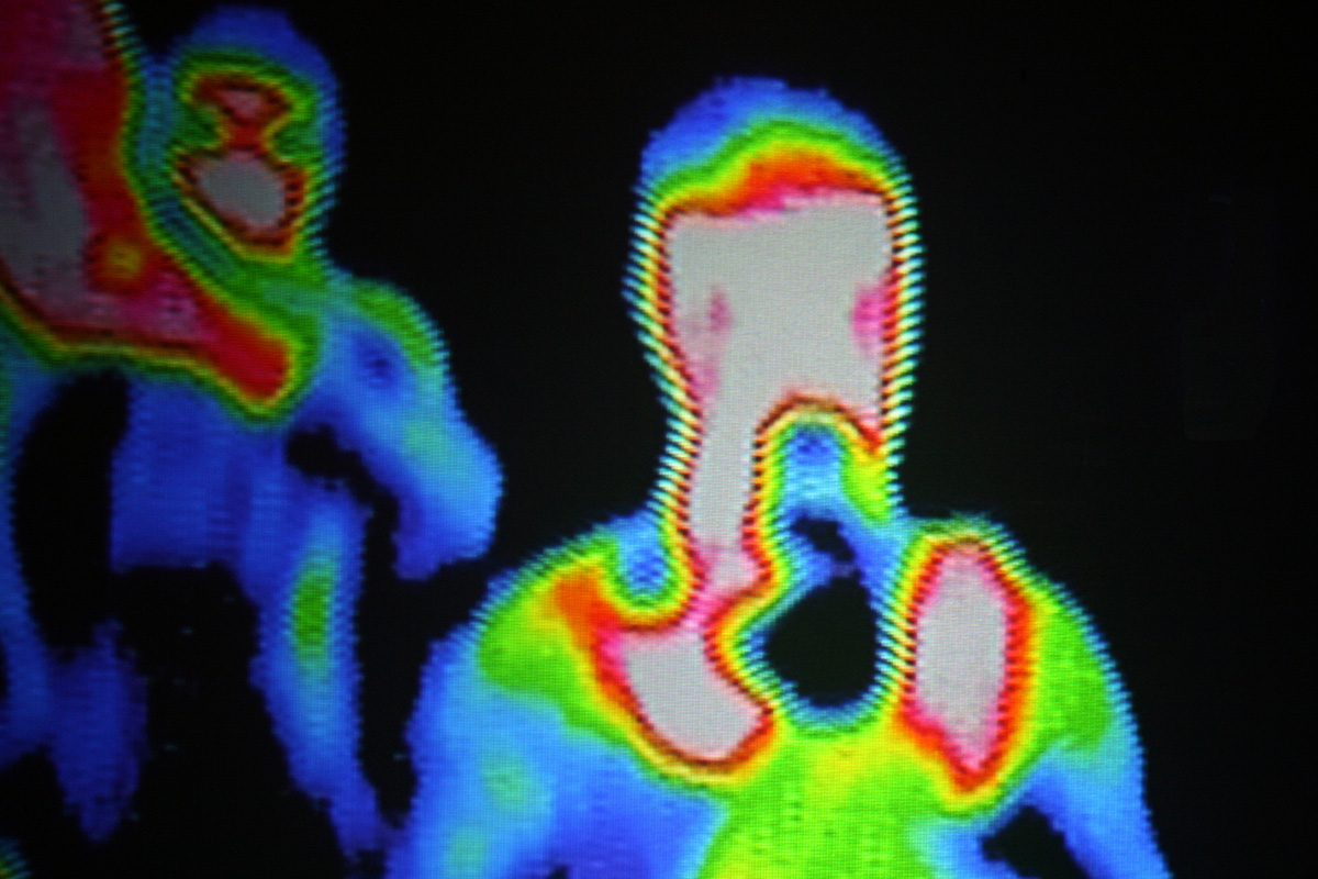 Termal kamera vücut ısısını tespit edebilir.