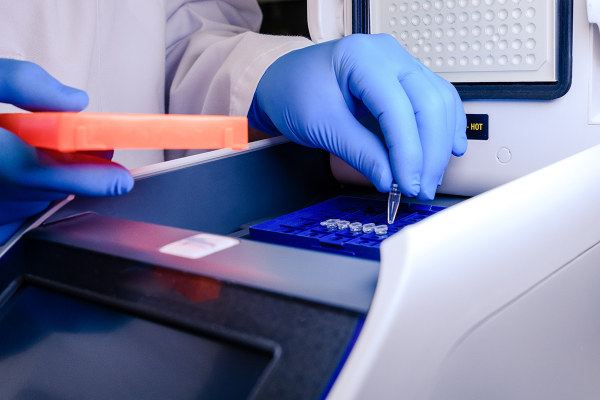 Koronavirüs Teşhisinde de Kullanılan PCR Yöntemi Nedir?