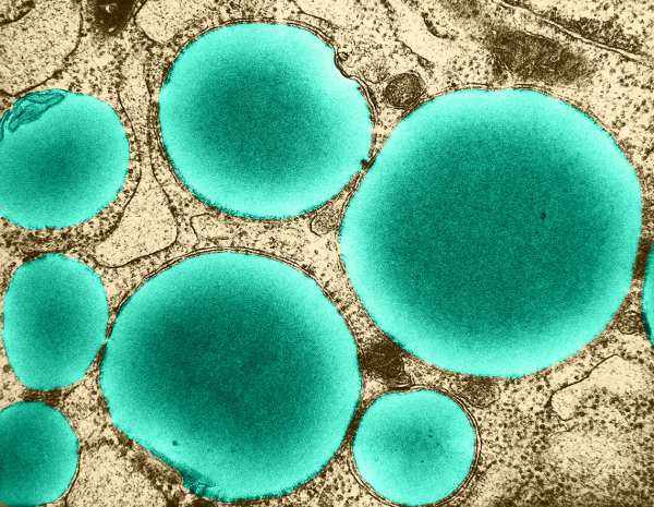 Mikroplarla Savaşan Yağ Damlacıkları